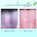 Adult Tongue Scraper Cleaner - Fresh Breath Tongue Brush (6 Pack, Random Color) - Buy Online on GoSupps.com