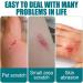 10ML Waterproof Transparent Liquid Bandage | Quick-Dry Wound Care for Cuts & Scrapes - 1pcs - Buy Online on GoSupps.com