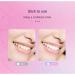 Professional Teeth Whitening Strips 14 Pairs Mint Flavor 30 Minute Treatment 14 Day Treatment - Buy Online on GoSupps.com