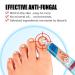 Best Nail Repair Cream for Fungus Treatment - Restores Discolored Nails - Toe & Finger Care - Buy Online on GoSupps.com