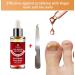 Extra Strength Toe Nail Fungus Treatment - Nail Repair Solution for Damaged Nails - Buy Online on GoSupps.com