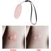 Harayaa Sting & Bite Relief Pen - Portable Antipruritic Device for Men & Women - Outdoor Skin Itch Relief Tool in Pink - Buy Online on GoSupps.com