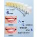 MySmile Teeth Whitening Strips Kit 14 Treatments with 28 LED Light - 10 Min Non-Sensitive Fast Whitening Teeth Enamel Safe Teeth Whitener - Helps to Remove Deep Stains 28 Fl Oz (Pack of 1) - Buy Online on GoSupps.com