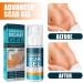 YoNGBAO Scar Removal Cream: Natural Extract, Brightens Skin, Improves Surgical Scars - Buy Online on GoSupps.com
