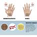 1Pairs Arthritis Gloves Touch Screen Gloves Anti Arthritis Therapy Compression Gloves and Ache Pain Joint Relief Winter Warm Gray Large - Buy Online on GoSupps.com