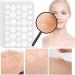 Rpanle Acne Patches 180 Pcs - Hydrocolloid Dots for Spots - Calms & Relieves Acne - Facial Care (12mm & 8mm) - Buy Online on GoSupps.com