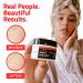 Yeouth Retinol Eye Cream with Hyaluronic Acid - Dark Circle and Puffiness Treatment - Buy Online on GoSupps.com