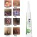 Semme Hemorrhoids Ointment Cream - Fast Relief for Internal & External Piles, Anal Fissure (1 Pack) - Buy Online on GoSupps.com