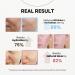 La Noubelle MPC Stem Cell Moisturizing Cream Anti-aging, Wrinkle Care, Skin Regeneration. Firming, Deep Hydration, Face Moisturizer with Caviar, Niacinamide and Peptides, Korean Skin Care 3.38 fl oz - Buy Online on GoSupps.com