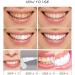 White Teeth Pen - On-the-Go Teeth Whitening Gel | Peroxide-Free Professional Formula - Buy Online on GoSupps.com