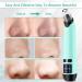 Blackhead Remover Pore Vacuum Cleaner - Electric Acne & Comedone Extractor | Facial Suction Tool for Men & Women - Blue - Buy Online on GoSupps.com
