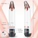 OMANIAC Blackhead Remover Vacuum with Hot Compress Kit | Rechargeable Electric Blackhead Cleaner with 4 Suction Probes and Acne Removal Tools - Buy Online on GoSupps.com