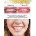 Orthodontic Rubber Bands 3/16 - 300 Elastic Bands & 30 Dental Floss - Braces Fix & Clean Tools - Buy Online on GoSupps.com