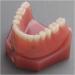 Fhuili Teeth Model for Education | Dental Implant Repair & Communication | Red Dentition Simulation Tool - Buy Online on GoSupps.com