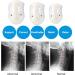 3 Sizes Breathable Neck Orthosis | Neck Support Braces for Spine Alignment & Chronic Pain Relief (Large) - Buy Online on GoSupps.com