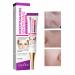 Dark Spot Remover for Face&Body Skin Whitening Freckle Cream Skin Lightening Cream Dark Spots Corrector for Sun Spot Age Spot Smooth Melasma Hyperpigmentation Age Dark Spot Corrector 0.71oz