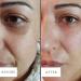 LuxeBiotics Dark Circle Eye Bag Anti-Wrinkle Nourishing Eye Cream - Nourish, Brighten, and Smooth Skin - Buy Online on GoSupps.com