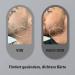 Buy Koi Beauty Bartroller 0.5 mm - Professional Dermaroller for Beard Hair & Skin Care | 540 Titanium Needles for Men & Women | Enhance Hair Growth at Home - Buy Online on GoSupps.com