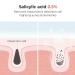 Salicylic Acid Daily Gentle Cleanser 150 ml | Acne Treatment | Exfoliating Face Wash - International Shipping Available - Buy Online on GoSupps.com