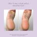 Buy EXUVIANCE Exfoliating & Conditioning Foot Balm - 1.7 oz | International Shipping Available - Buy Online on GoSupps.com