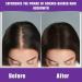 Buy Anti-Hair Loss Shampoo #2 - MCB Biotechnology & Silk Spider Formula | 11 Oz | International Shipping Available - Buy Online on GoSupps.com