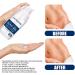 Silicone Skin Renewal Gel - Women's Treatment for Surgical Scars, Stretch Marks, Acne, Burn Scars & Pockmarks - 1pcs - Buy Online on GoSupps.com