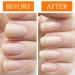Nail Tek Nail Recovery Kit: Cuticle Oil, Strengthener, Ridge Filler - Restore Damaged Nails in 3 Steps - Buy Online on GoSupps.com