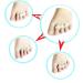 Careforyou Gel Toe Spreader for Small Toes - 4 Piece Toe Separators & Bale Protection for Sports - Buy Online on GoSupps.com