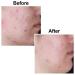 Kojie San Body Lotion 150ml - Hyperpigmentation Control & Blemish Reduction - Buy Online on GoSupps.com
