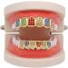 H.eternal Cap Top Hip Set Tooth Rainbow Copper Grill Jewelry - Premium Teeth Grill with Dental Care Pro 3000 Case - One Size - International Shipping Available - Buy Online on GoSupps.com