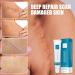 Acne Scar Treatment Gel - Scar Remover for Face & Body - 20g - Buy Online on GoSupps.com