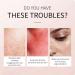 RoseFlower Makeup Remove Balm Travel Protable Deep Cleansing Purifying Face Cleanser Balm Emulsification Cleansing Moisturizing Gentle and Non-irritating #2 #4 - Buy Online on GoSupps.com