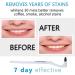 RMFC 2PCS Tartar Remover Tooth Stain Eraser Teeth Polishing/ Cleaning Kit Removes Plaque & Impurities (White & Blue) - Buy Online on GoSupps.com