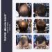 Super Million Hair 15g - No.2 Dark Brown: Instant Hair Loss Concealer - Buy Online on GoSupps.com