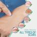 Sialicess Reusable Silicone Scar Strips for Keloid & Hypertrophic Scars - 2 Month Supply - 4 PCS - Buy Online on GoSupps.com