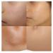 Tummy Scars Care Cream - Easy to Use 15Pcs Scar Removal Cream for Burn & Small Wounds - Buy Online on GoSupps.com