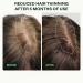Scandinavian Biolabs Hair Growth Serum for Women 3 Pack | Natural Hair Loss Treatment for Women Without Minoxidil | Hair Regrowth Treatment for Women - Buy Online on GoSupps.com
