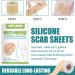 Silicone Scar Gel Strip - Efficient Scar Treatment for Surgery, Acne & Trauma - 4 * 150cm - Buy Online on GoSupps.com