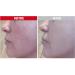 Altruist Dermatologist Anti Redness and Pigmentation SPF50 Tinted Face Cream Unscented 30 ml (Pack of 1) Anti Redness & Pigmentation - Buy Online on GoSupps.com