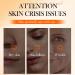 Wenrny 5X Vitamin C Face Cream for Women 2 Pack Vitamin C Face Moisturizer Cream for Hydrating Moisturizing Glowing Skin and Suitable for All Skin types Skin Repair Face Lotions Gifts 1.7 Oz - Buy Online on GoSupps.com