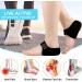 Heel Protectors & Cushion Cups for Plantar Fasciitis | Gel Heel Pads for Pain Relief in Men & Women | 1 Pair Black - Buy Online on GoSupps.com