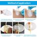 Atacesotaiv 5 pcs Catheter Stabilization Device - Foley Catheter Adhesive Sticker with Foam Anchor Pad - Leg Band Urinary Catheter Hook and Loop Fixing Device (White) - Buy Online on GoSupps.com