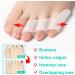 Sumifun Pinky Toe Separators - 12 Pack Clear Little Toe Spacers for Overlapping and Curled Toes - Buy Online on GoSupps.com