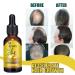 Luxsea Ginger Hair Care Nutrient Solution - Buy Online on GoSupps.com