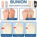 NOWLIN Orthopedic Bunion Relief Socks - Skin Tone, Women's One Size - Buy Online on GoSupps.com
