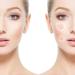 VONKMATT Acne Patches 180 Pcs | Invisible Spot Treatment Stickers | Anti-Acne Dots for Pimples | Skin Care Solution - Buy Online on GoSupps.com