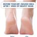 Moisturizing Heel Socks for Cracked Heel Treatment - 2 Pairs by Dr. Frederick's Original - Buy Online on GoSupps.com
