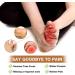 50 Pcs Silicone Anti-Friction Toe Protector Breathable Gel Toe Protector Little Toe Cover Protectors Caps for Men and Women Toe Sleeves with Hole to Protect Toe from Rubbing Corns Blisters etc - Buy Online on GoSupps.com