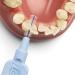 TePe Interdental Brush Extra Soft Blue - 8 Pieces Pack for Gentle Dental Care | International Shipping Available - Buy Online on GoSupps.com