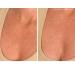 SiO Beauty Plunging Neckline - Overnight Silicone Smoothing Patches for Neck & Chest | Reusable SkinPad & Necklift - Shop Now - Buy Online on GoSupps.com